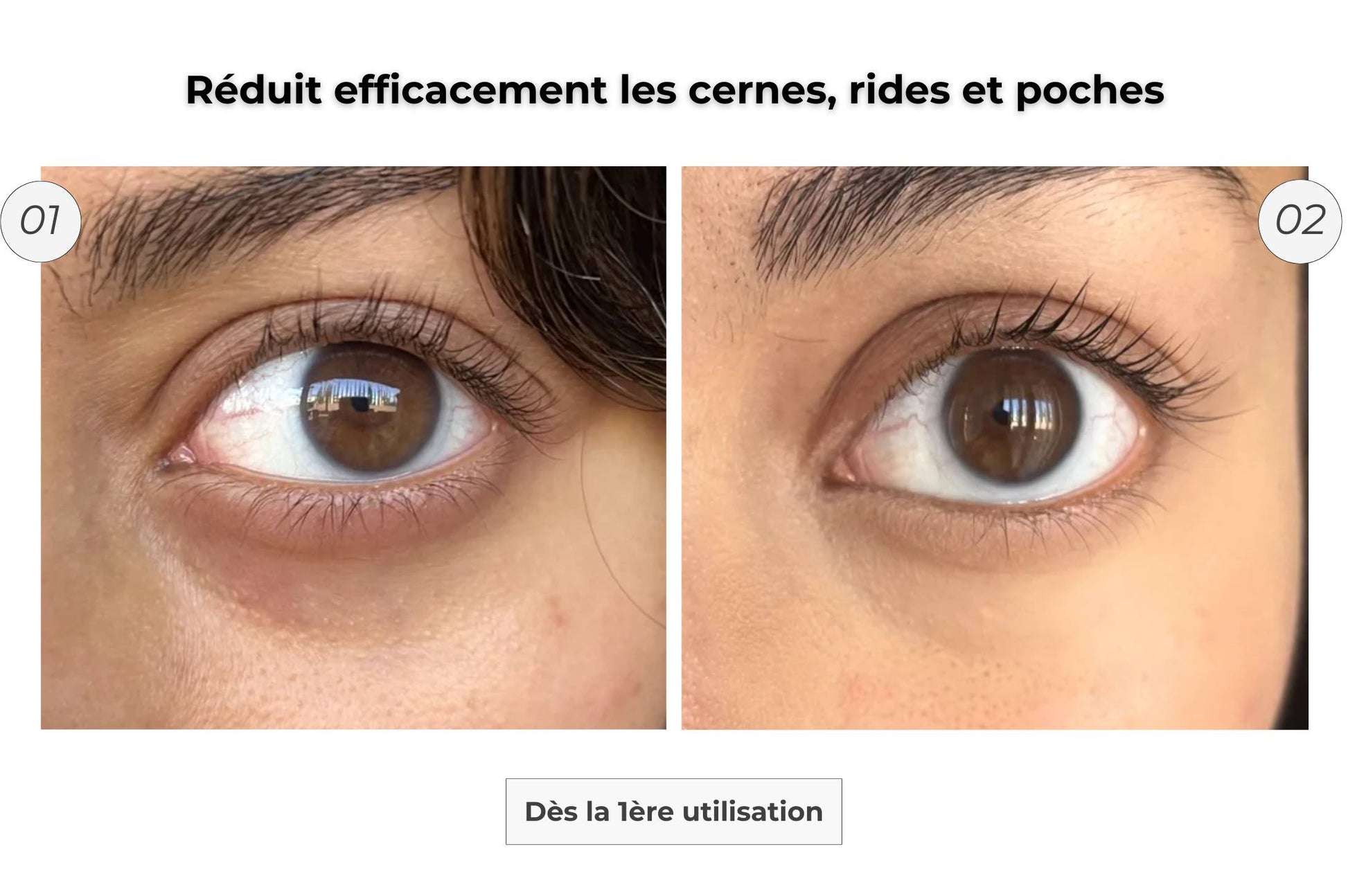 Patch Contour des Yeux Microneedling