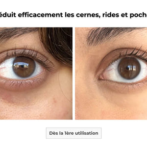 Patch Contour des Yeux Microneedling
