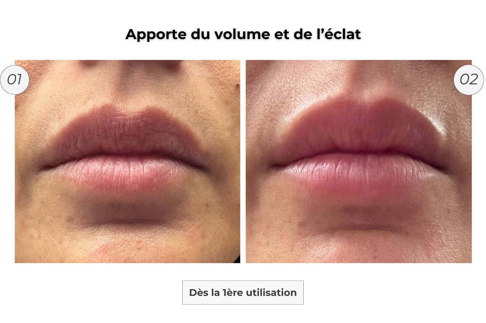 Patch Lèvres Microneedling