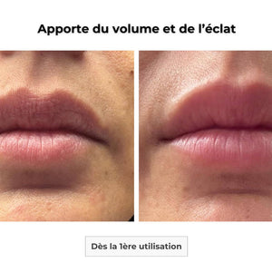 Patch Lèvres Microneedling