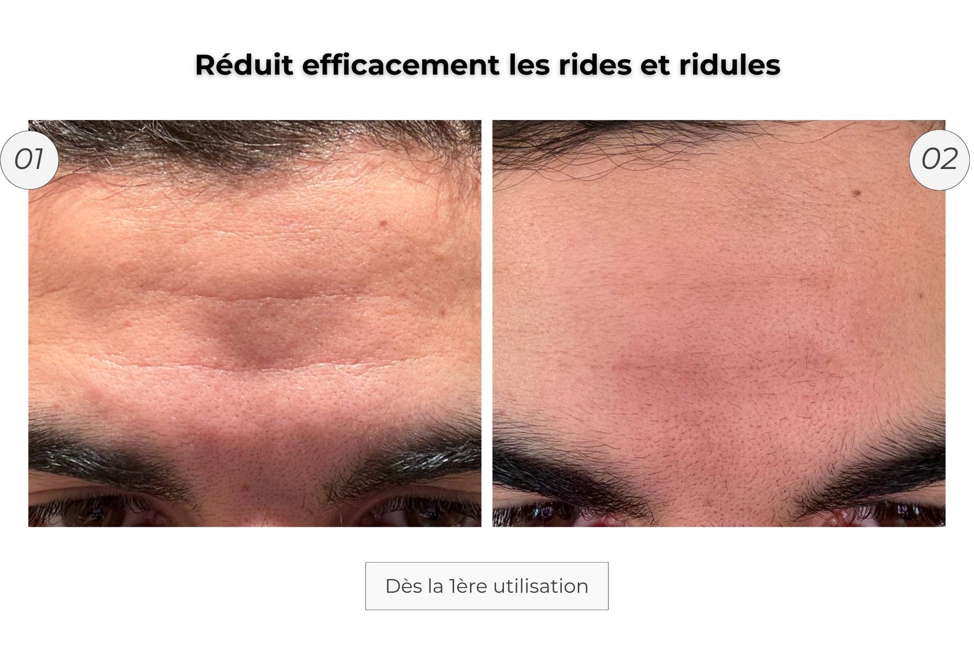Patch Anti-Âge Microneedling