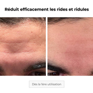 Patch Anti-Âge Microneedling